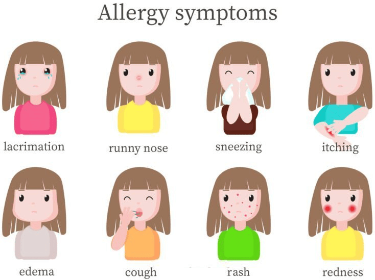 Symptoms of Allergic Reaction